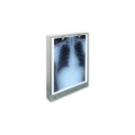 X-Ray Viewer – LED Medical Film Viewing Panel - Image 2